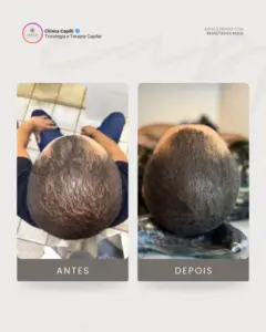 Tratamento Capilar